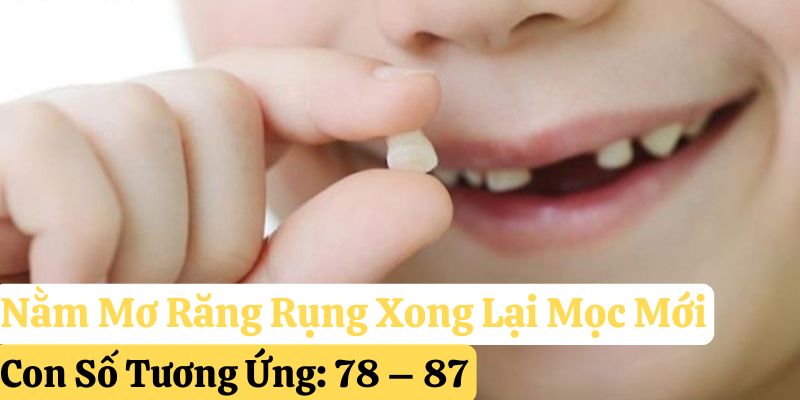 123win mơ thấy rụng răng đánh gì
