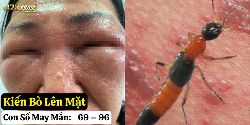 kiến hay bò lên người 123win