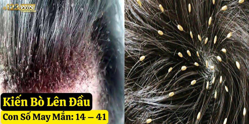 thấy kiến hay bò lên người